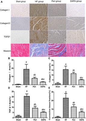 Dapagliflozin Attenuates Myocardial Fibrosis by Inhibiting the TGF-β1/Smad Signaling Pathway in a Normoglycemic Rabbit Model of Chronic Heart Failure